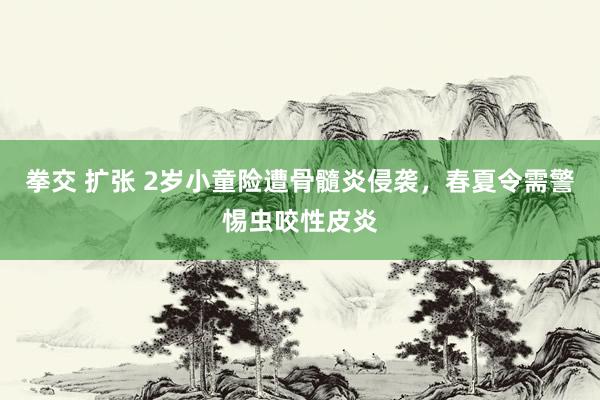 拳交 扩张 2岁小童险遭骨髓炎侵袭，春夏令需警惕虫咬性皮炎